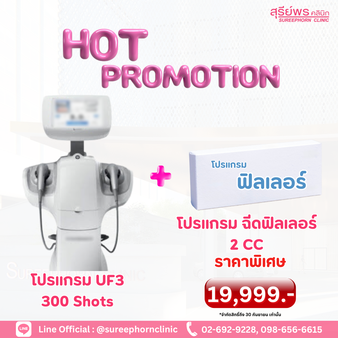 Hot Promotion 🔥