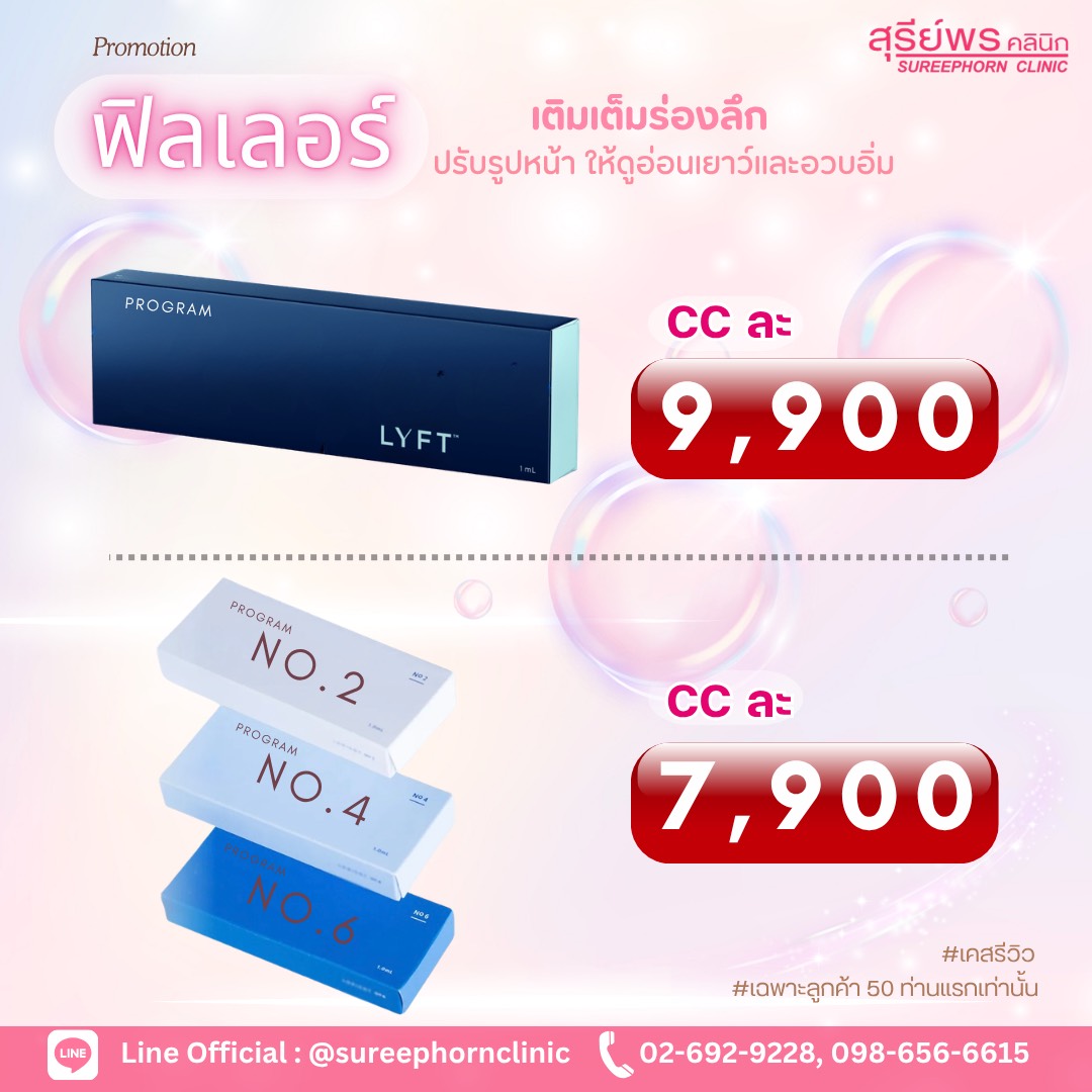 🎉 Promotion ฟิลเลอร์